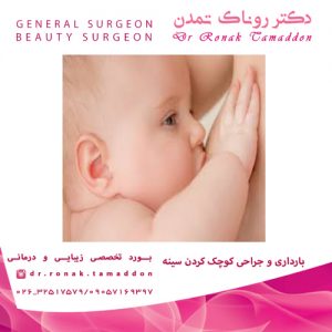 بارداری و جراحی کوچک کردن سینه